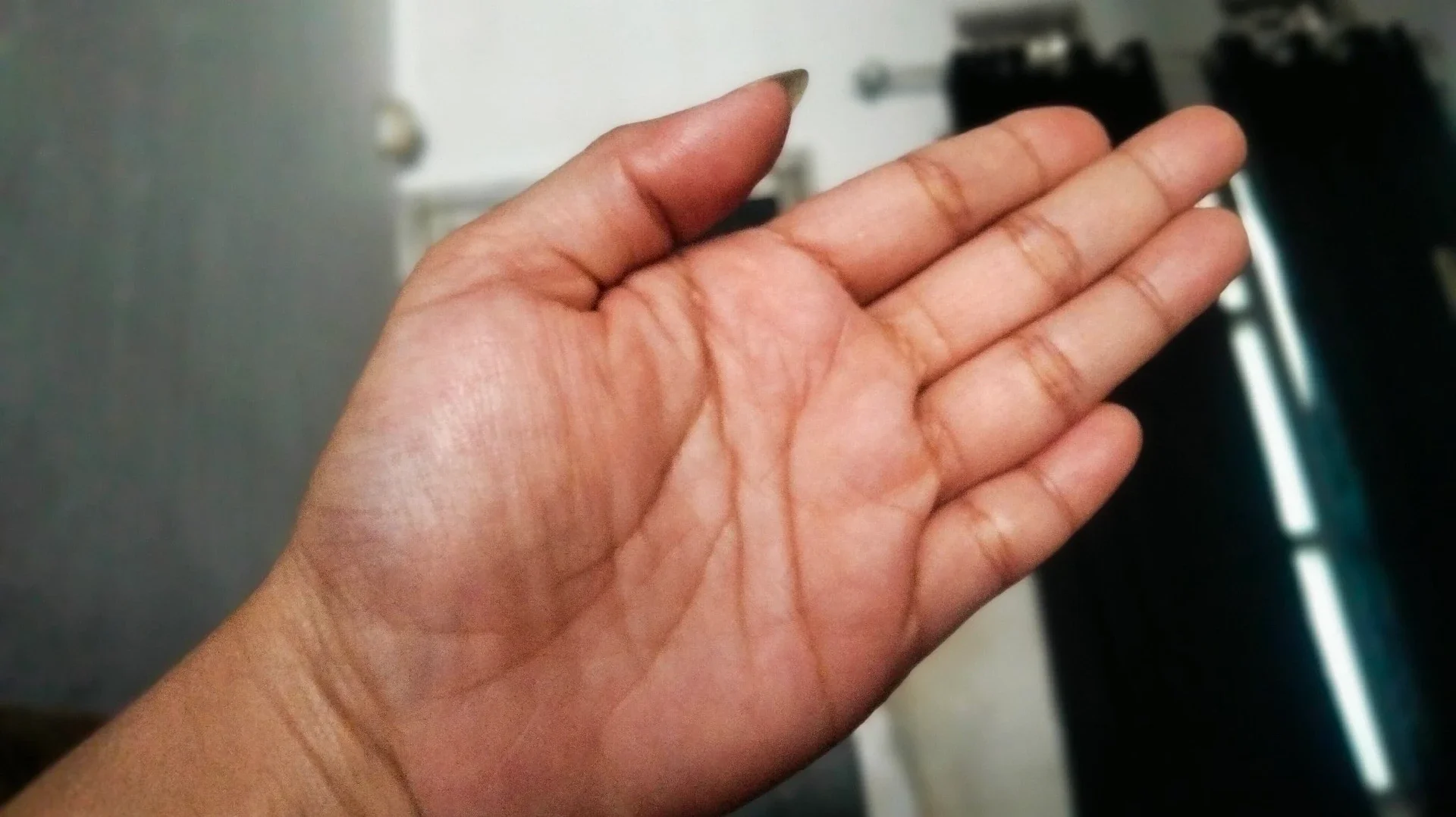 #JagaJantungVersiku TELAPAK TANGAN BERKERINGAT
